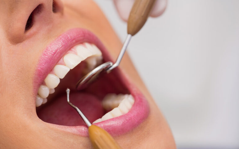 dentist-examining-female-patient-teeth (1)